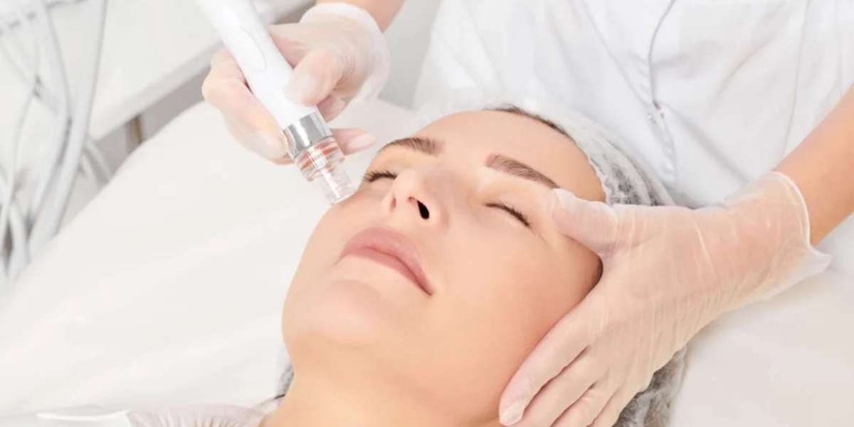 Key Benefits of Non-Surgical Skin Tightening: Exclusive Aesthetics & Wellbeing