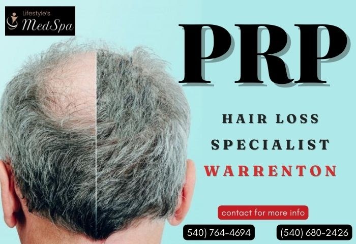 PRP Hair Loss Specialist - Warrenton