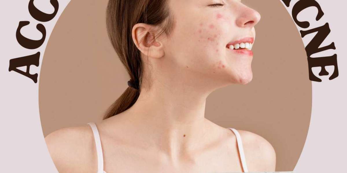 What is the strongest acne medication?