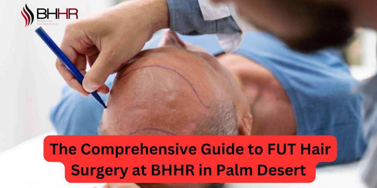 The Comprehensive Guide to FUT Hair Surgery at BHHR in Palm Desert 
