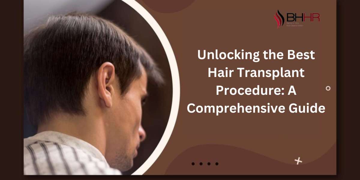 Unlocking the Best Hair Transplant Procedure: A Comprehensive Guide