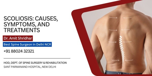 Scoliosis: Causes, Symptoms, and Treatments – @dramitshridhar on Tumblr