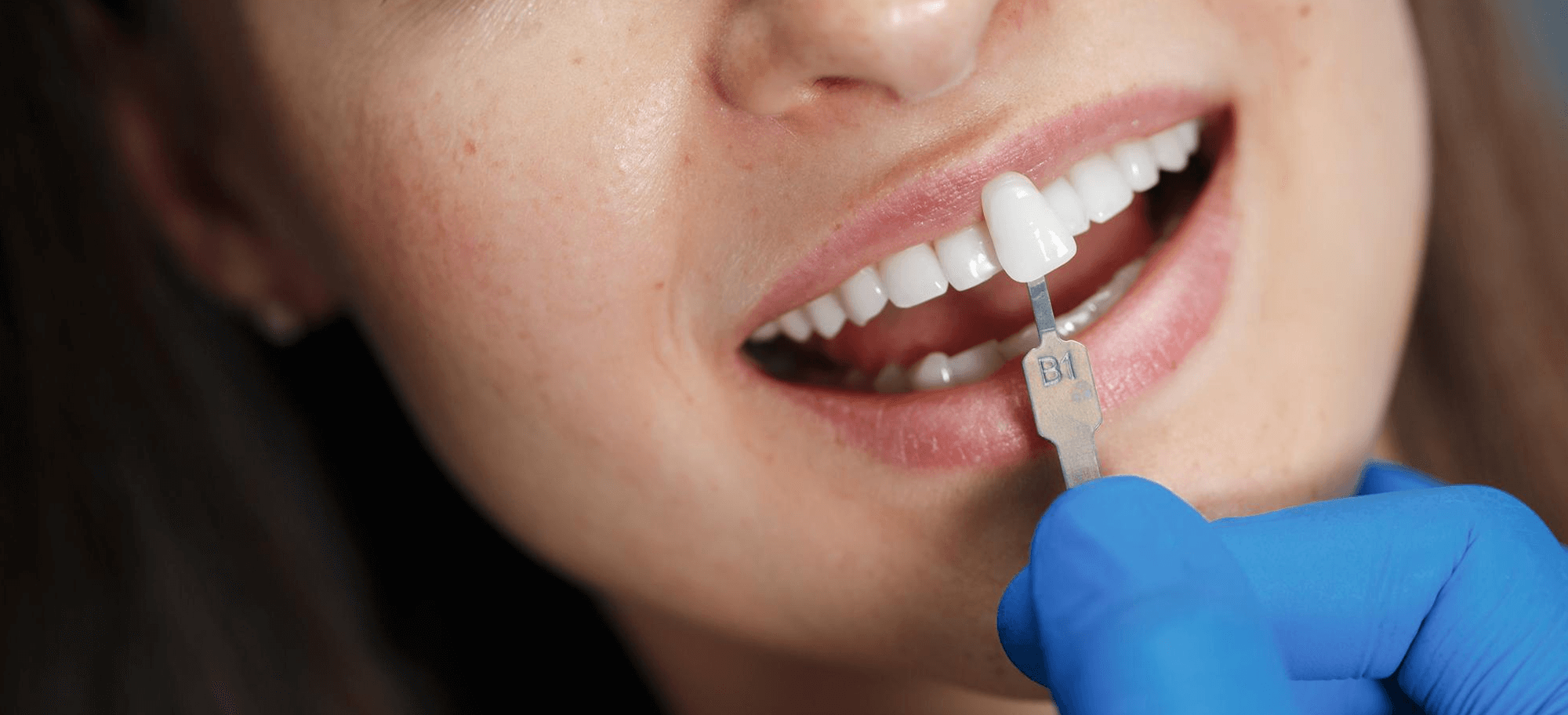 Customized Prosthodontics Billing Services | Dental Billing