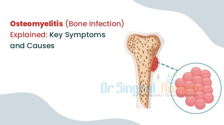 Osteomyelitis - Symptoms and causes