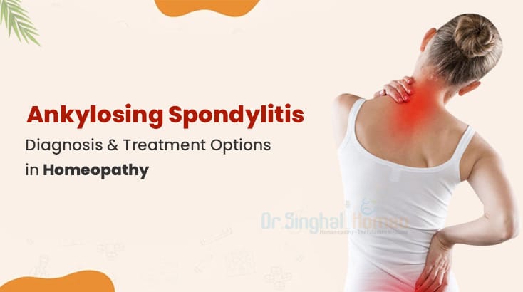 Find Ankylosing Spondylitis Diagnosis and Treatment- An Overview