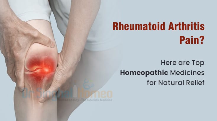 Find the Top Homeopathic Medicines for Rheumatoid Arthritis