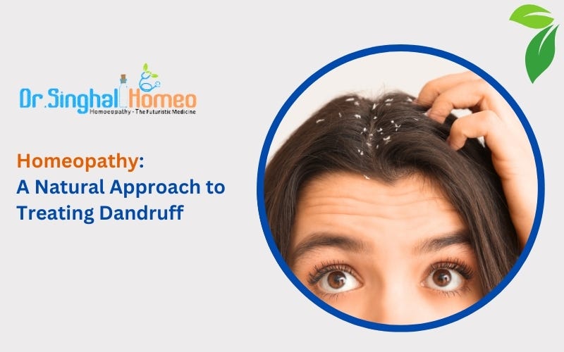 Homeopathy: A Natural Approach to Treating Dandruff | by Dr. Singhal Homeo | Mar, 2025 | Medium