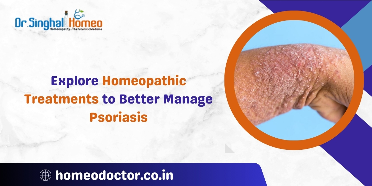 Psoriasis Treatment in Homeopathy: A Natural Approach to Skin Health – health