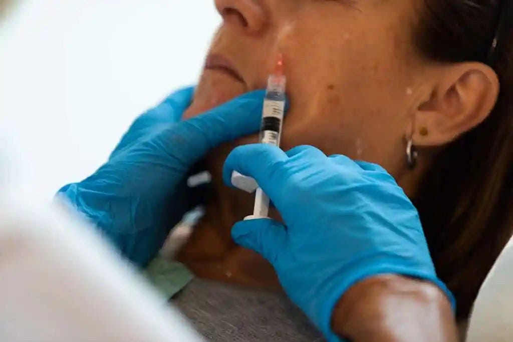 Tips for Taking Care of Your Dermal Fillers: How to Make Them Last | by Elm Skin clinics | May, 2025 | Medium